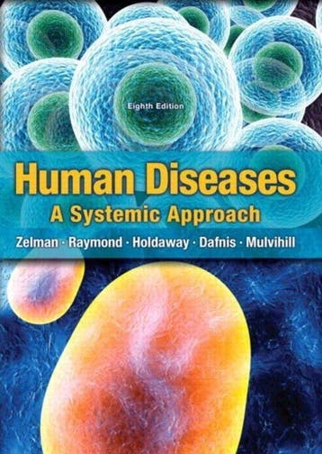 Human Diseases 9780133424744 Zelman Mark, Verzenden, Gelezen, Zelman Mark