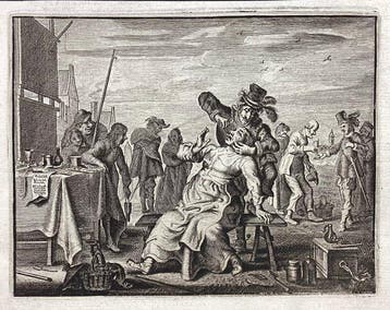 Adriaen Van de Venne (1589-1662), after - Il cavadenti