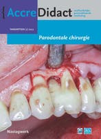 Parodontale chirurgie / AccreDidact / 2022/2 9789089764577, Boeken, Verzenden, Zo goed als nieuw, Alexander Verhelst