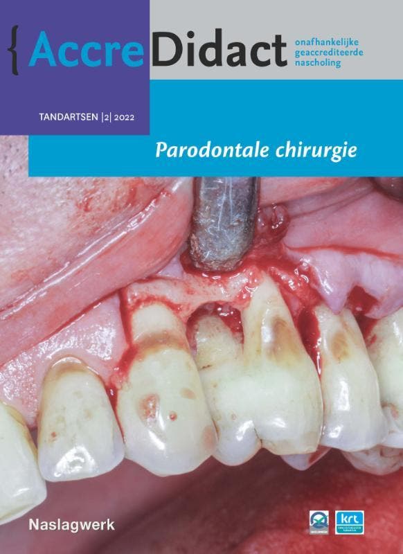 Parodontale chirurgie / AccreDidact / 2022/2 9789089764577, Livres, Science, Envoi