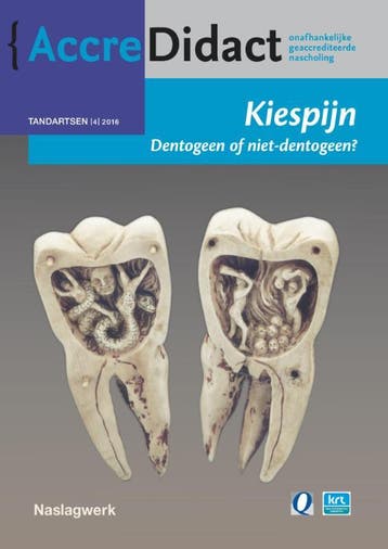 Kiespijn, dentogeen of niet-dentogeen? / AccreDidact /, Verzenden, Jan Warnsinck
