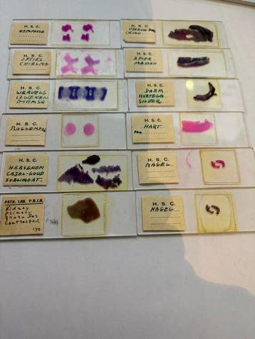 Microscope slide - histology and pathology slides -