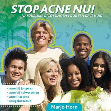 STOP ACNE NU ! - Horn, Verzenden