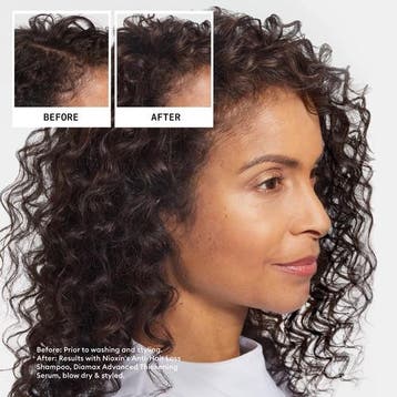 Nioxin Anti-Hairloss Shampoo, Verzenden, Gel, Wax, Haarlak of Mousse