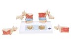 Anatomisch model osteoporose ST-ATM 45, Verzenden, Nieuw
