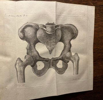 Jean-Louis Baudelocque - L’art des Accouchemens Tome I -