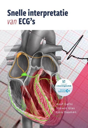 Snelle interpretatie van ECGs 9789083139319 Asaf Gafni, Verzenden, Asaf Gafni
