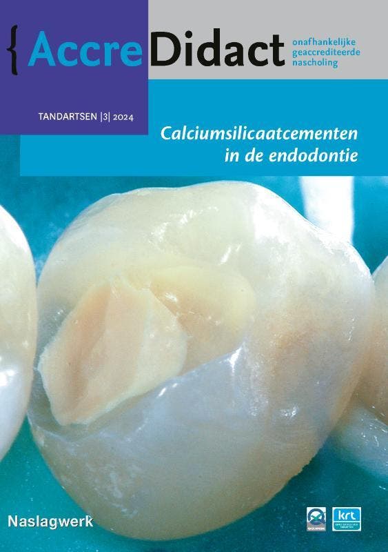 Calciumsilicaatcementen in de endodontie / AccreDidact /, Boeken, Wetenschap, Zo goed als nieuw, Verzenden