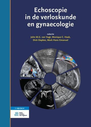Echoscopie in de verloskunde en gynaecologie 9789036814508, Verzenden, Gelezen