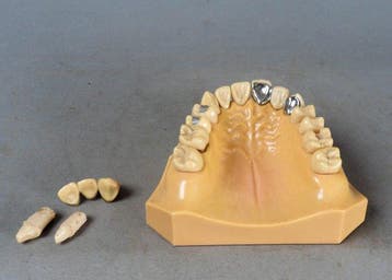 Instrument médical - Caoutchouc, dentier - modèle d’étude