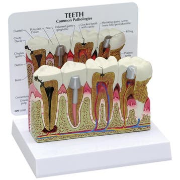 Anatomisch model voor tandheelkundige pathologieën ST-ATM 12, Verzenden