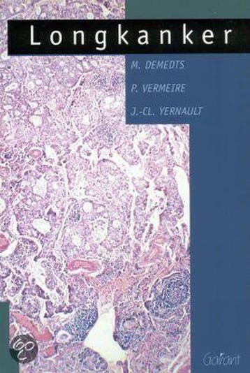 Longkanker / MIR / Medisch-informatieve reeks / 7 M. Demedts, Verzenden, M. Demedts