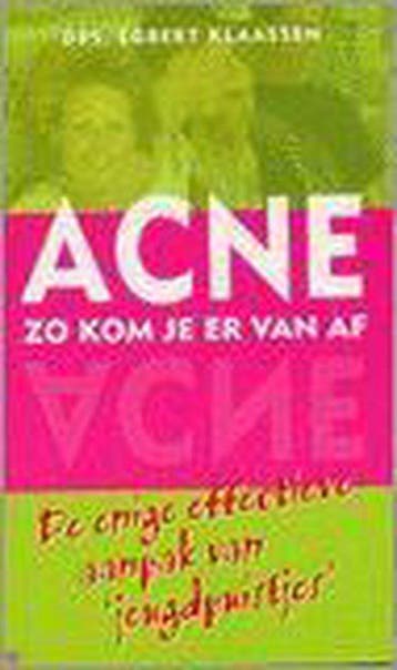 Acne Zo Kom Je Er Van Af - Klaassen, Verzenden, Nieuw